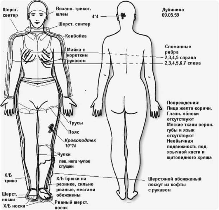 Одежда и повреждения тела Людмилы Дубининой.
